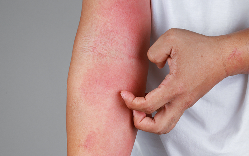 carpet cleaning in Nassau, carpet cleaner in Nassau, carpet cleaners in Nassau, carpet cleaners in Nassau, drapery cleaners in Nassau, carpet cleaning in Nassau, mattress cleaning in Nassau, mattress cleaners in Nassau, commercial carpet cleaning,commercial carpet cleaners in Nassau , Nassau rug cleaners, rug cleaning services in Nassau same day carpet cleaning, same day rug cleaning